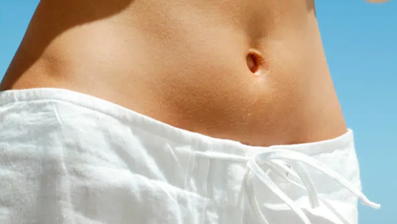 What is an Umbilicoplasty Navel Reshaping Explained