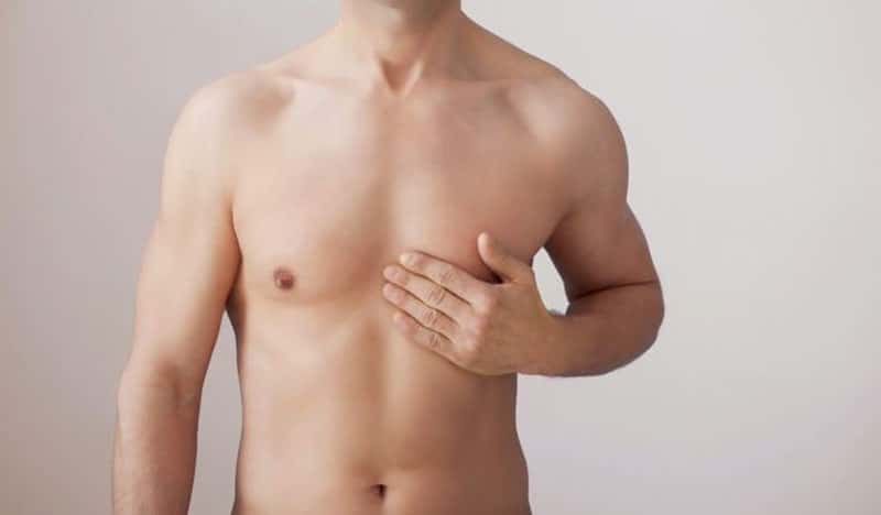 Third nipple removal