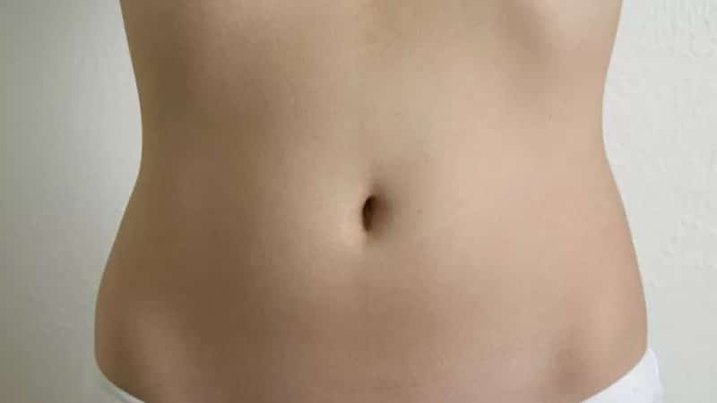 tummy tuck belly button