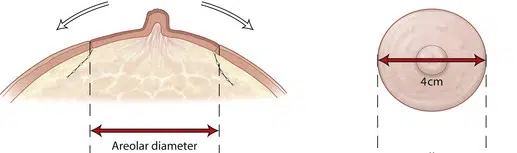 areola dimensions