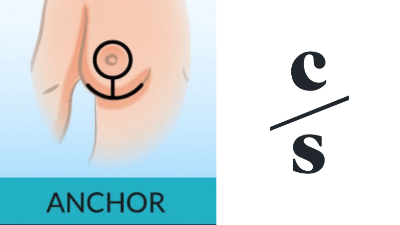 Breast Reduction Surgery London Anchor Scar Incision Centre for Surgery London