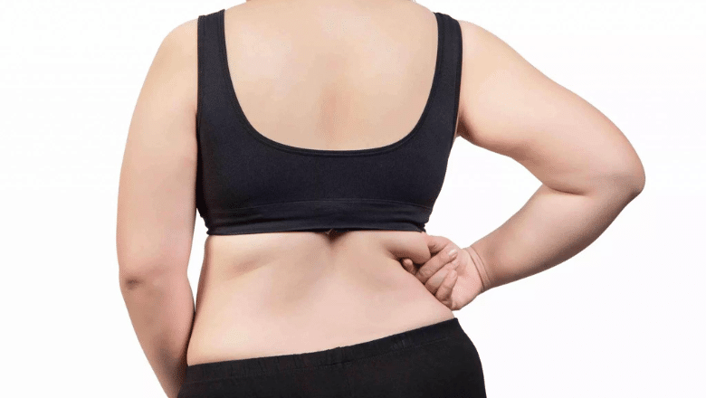 Am I a candidate for bra-line back lift surgery