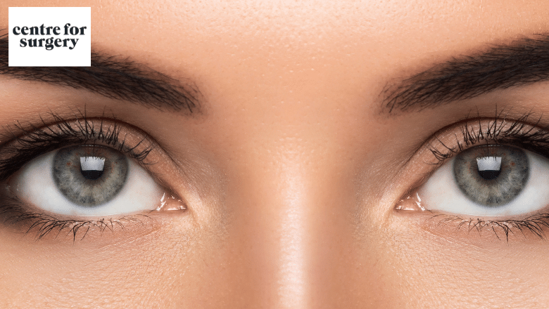 Benefits of Canthoplasty & almond eye surgery
