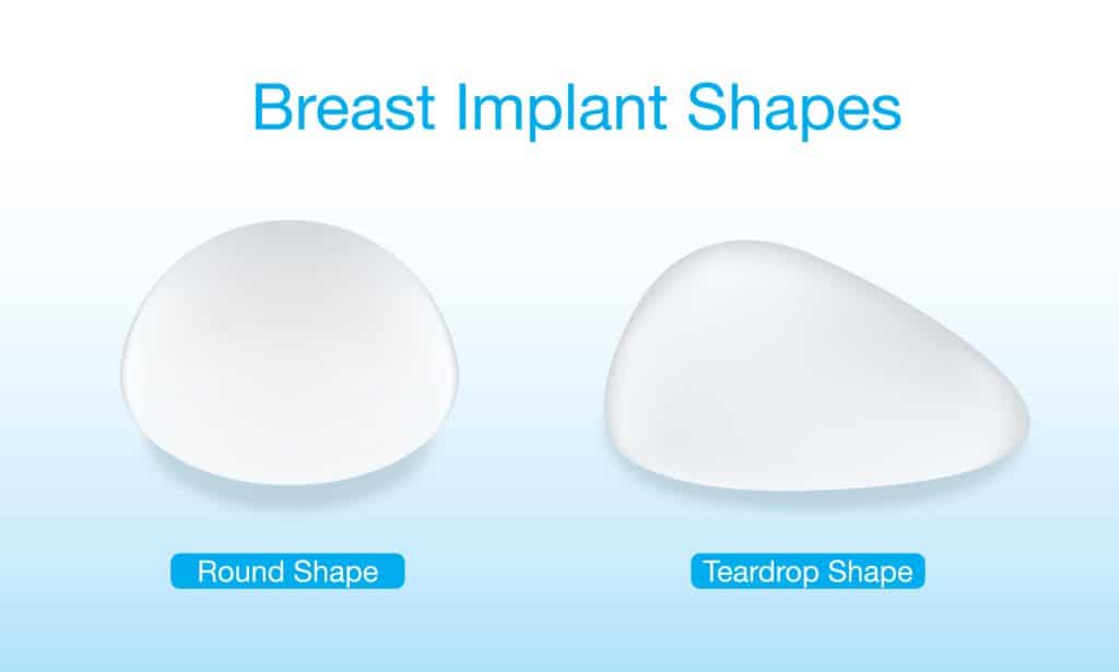 round vs teardrop implants