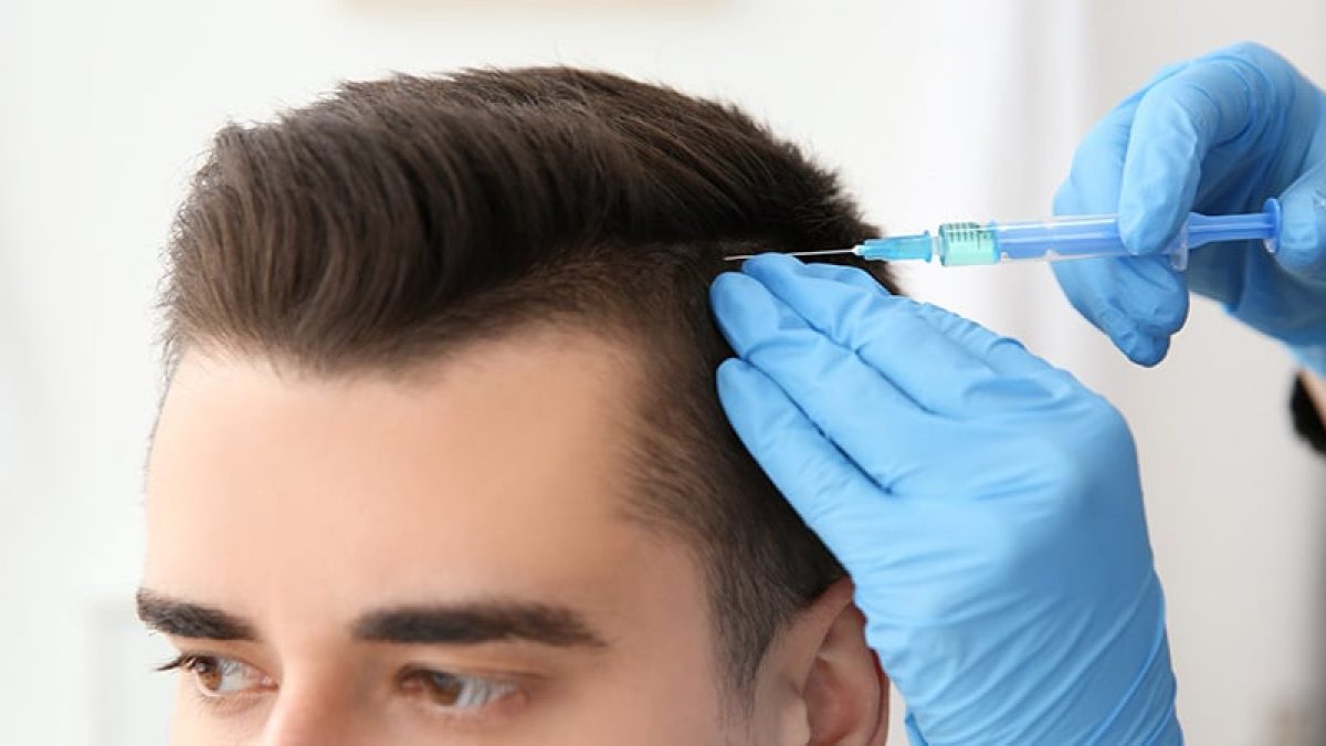 Hair Loss Injections London UK | Hair Loss Clinic | Centre for Surgery