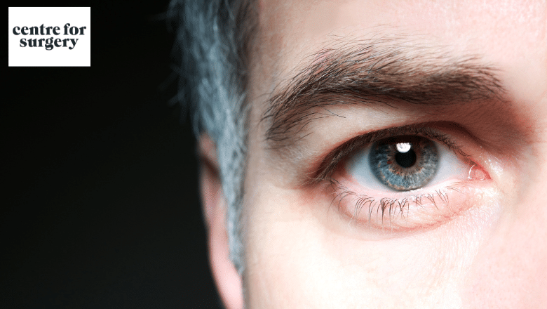 What does eyelid surgery for men involve