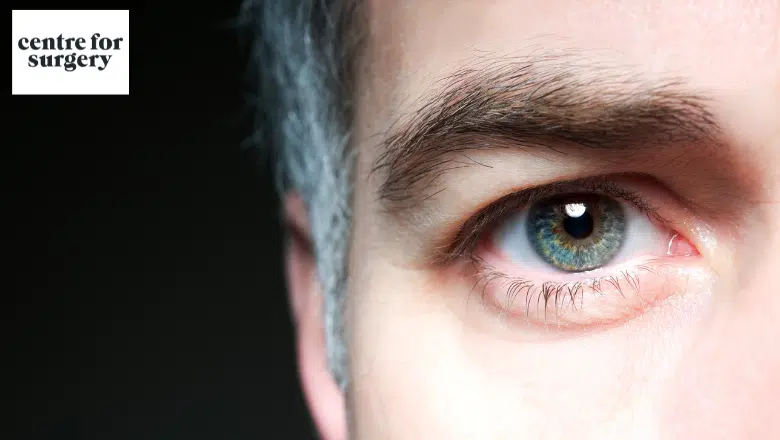 What does eyelid surgery for men involve