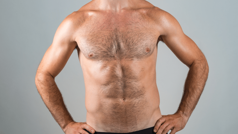 gynecomastia vs chest fat