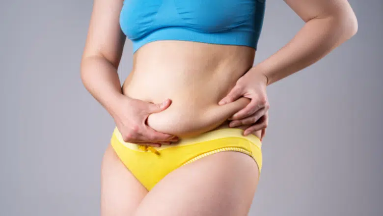 how to get rid of stomach overhang with tummy tuck