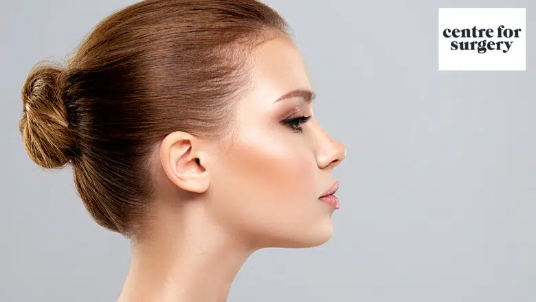 Nose Bridge Rhinoplasty London UK