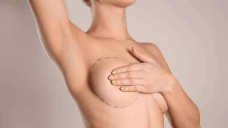 How To Fix Uneven Breasts - Solutions for Breast Asymmetry