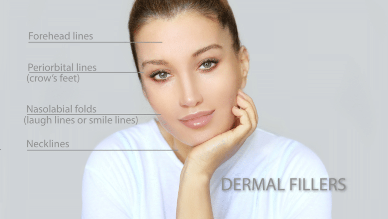 facial fillers treatment areas