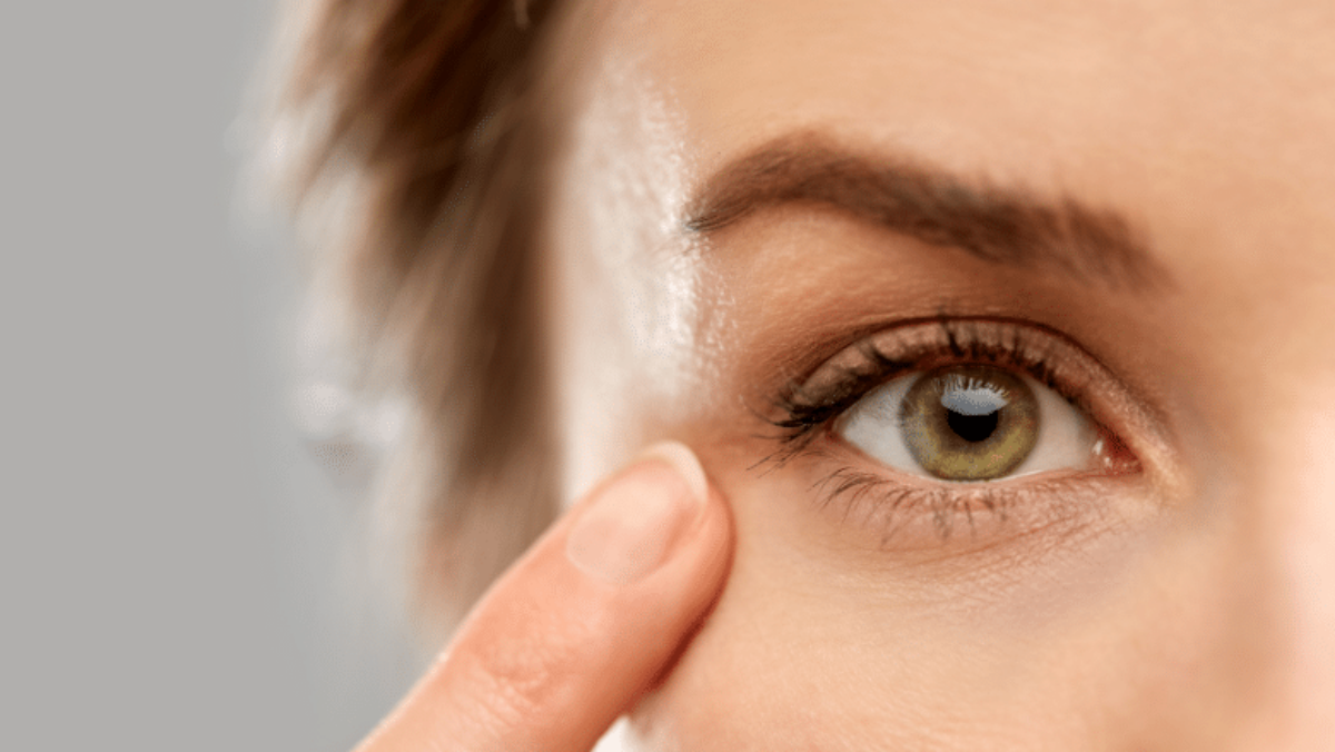 Calgary Laser Eye Tightening - Revive Laser and Skin Clinic