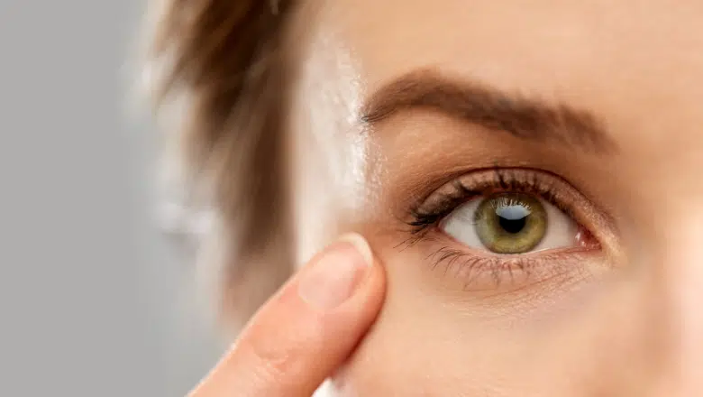 Veins Under Eyes Laser Treatment London & UK