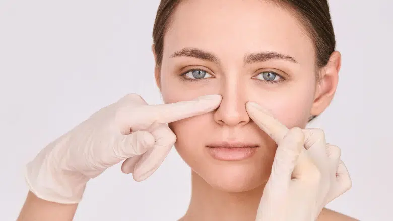 The Beginners Guide to Rhinoplasty