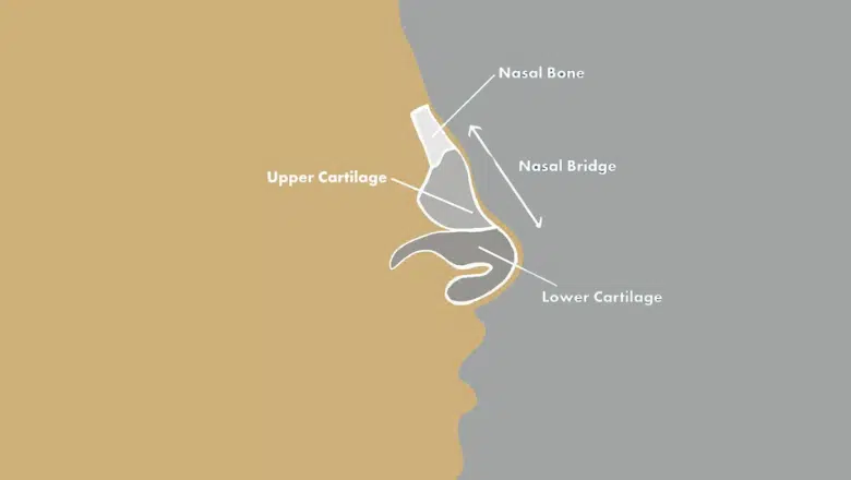 Saddle Nose Causes, Symptoms, and Treatments